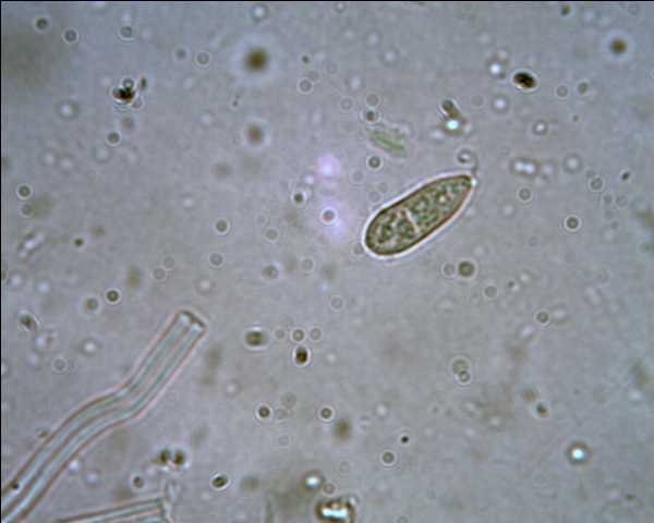 Schizophora paradoxa parassitata da Colletotrichum sp.